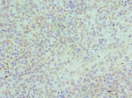 HNRNPD / AUF1 Antibody (aa1-306)