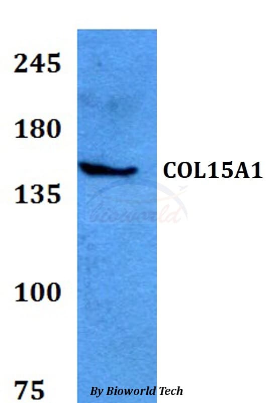 COL15A1 / Collagen XV Alpha 1 Antibody
