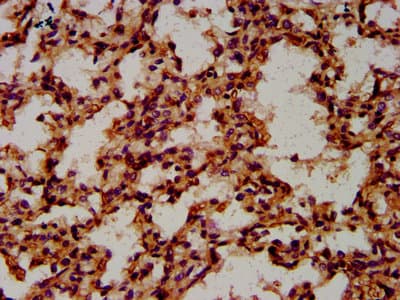 Polyclonal Rabbit anti-Human CPNE8 / Copine VIII Antibody (IHC)