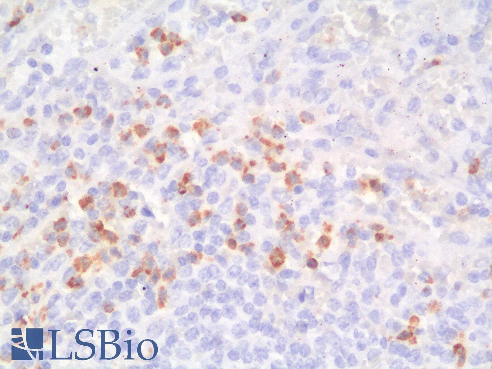 PathPlus™ FUT4 / CD15 Antibody (clone FUT4/1478R)