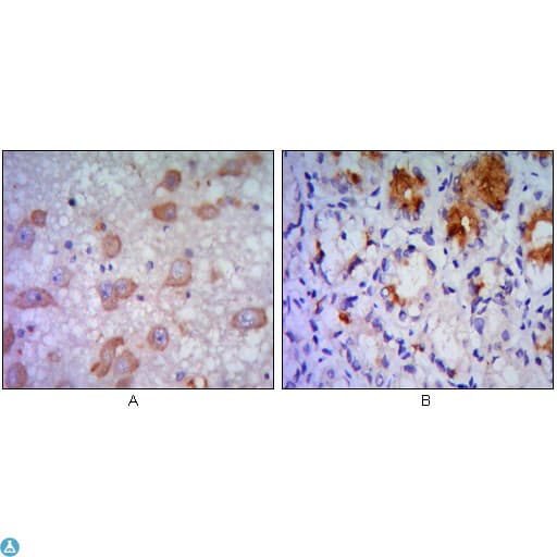 Monoclonal Mouse anti-Human ERN1 / IRE1 Antibody (IHC, WB)