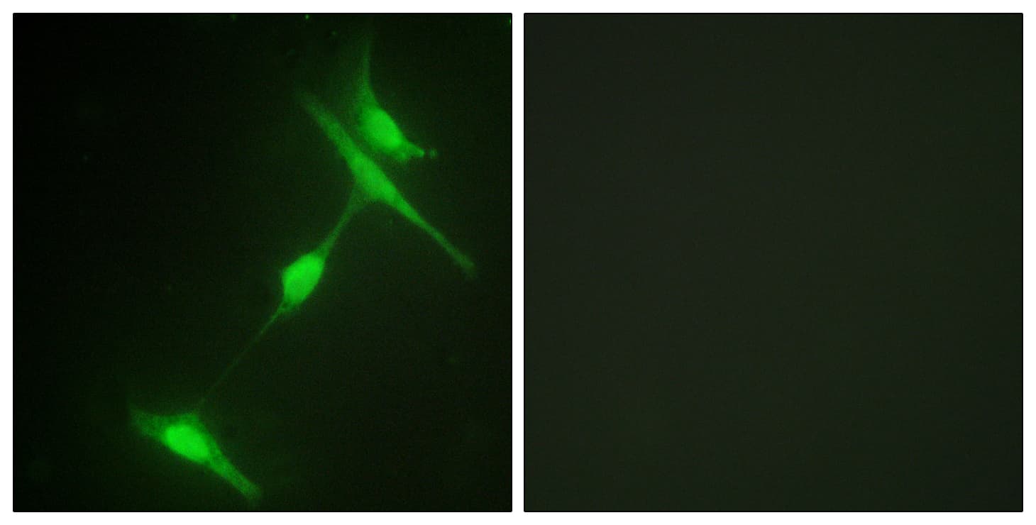 IHC-plus™ Polyclonal Rabbit anti-Human MAPK8IP1 / JIP1 Antibody (aa69-118, IHC, IF, WB)