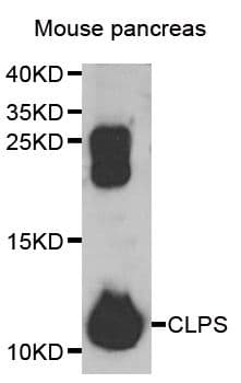 Polyclonal Rabbit anti-Human CLPS / Colipase Antibody (IHC, WB)