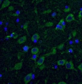HTT / Huntingtin Antibody
