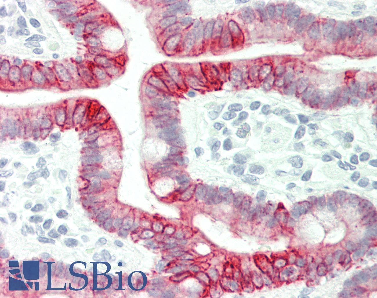 PathPlus™ KRT8 / CK8 / Cytokeratin 8 Antibody (clone 4D12)