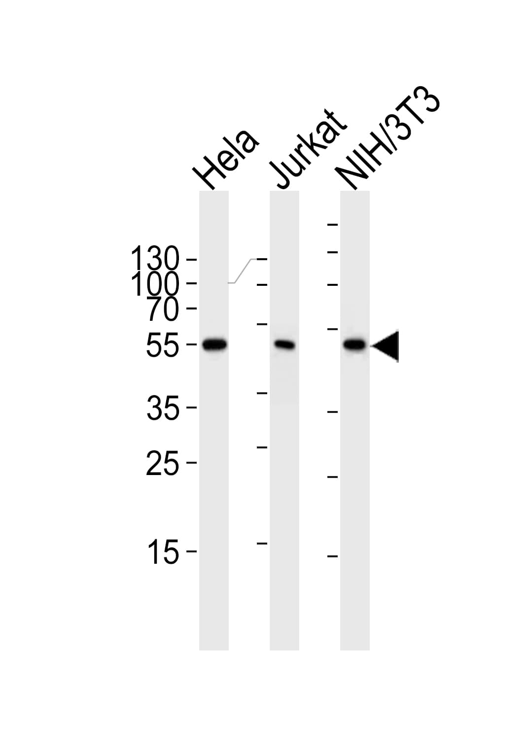 Monoclonal Mouse anti-Human PPARA / PPAR Alpha Antibody (clone 1331CT894.186.143, IHC, IF, WB)