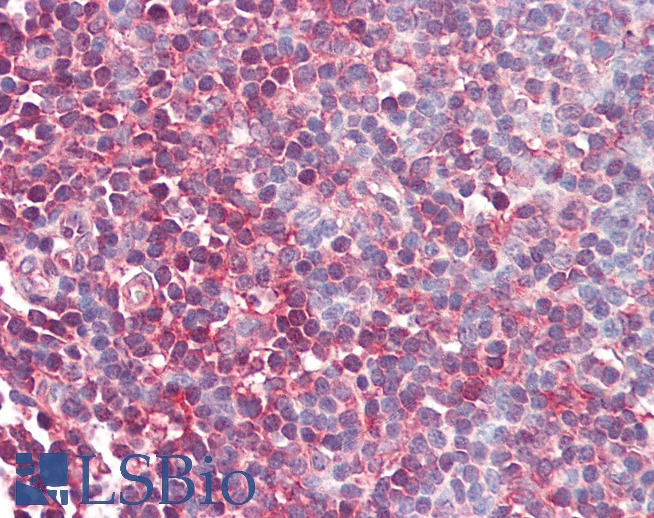 IHC-plus™ MAP2K1 / MKK1 / MEK1 Antibody (N-Terminus)