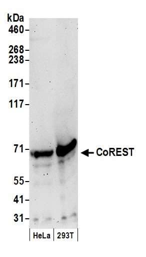 Polyclonal Rabbit anti-Human RCOR1 / COREST Antibody (aa425-C-term, IHC, WB)