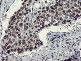 SENP2 Antibody (aa139-523, clone OTI5G8)