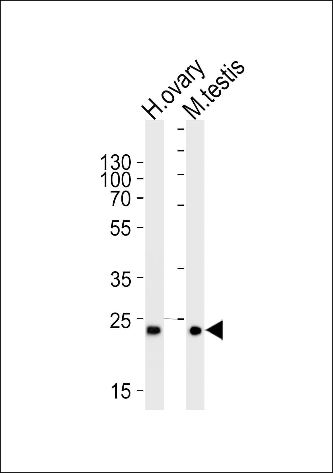Polyclonal Rabbit anti-Human PLD6 / Phospholipase D6 Antibody (aa125-154, WB)
