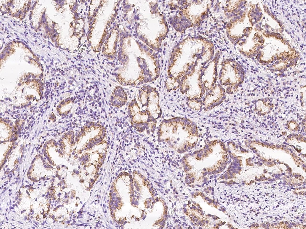 SPRYD5 Antibody