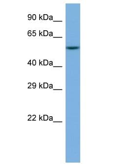 Polyclonal Rabbit anti-Human CCT8 Antibody (aa15-64, WB)