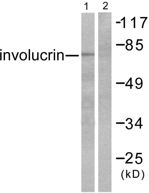 IVL / Involucrin Antibody
