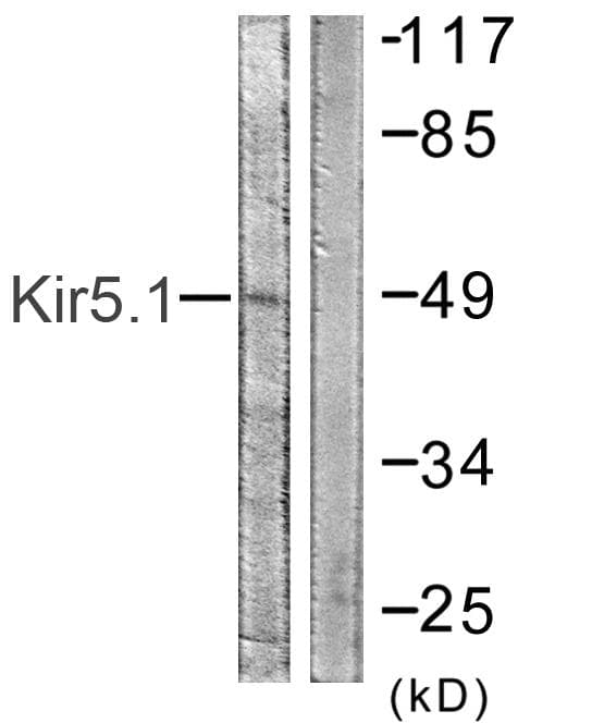 IHC-plus™ KCNJ16 / Kir5.1 Antibody (aa369-418)