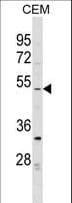 IHC-plus™ EVI2B Antibody (aa283-313)