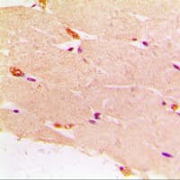 DES / Desmin Antibody (C-Terminus)