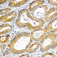 SGK1 / SGK Antibody (C-Terminus)