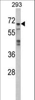 Polyclonal Rabbit anti-Human MAPK4 / ERK4 Antibody (aa72-101, IHC, WB)