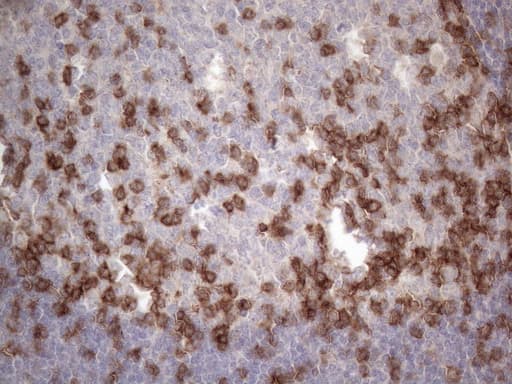Monoclonal Mouse anti-Human PDCD1 / CD279 / PD-1 Antibody (clone OTI2D10, IHC, WB)