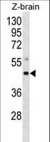 Polyclonal Rabbit anti-Mouse MAP2K4 / MKK4 Antibody (aa259-287, IHC, WB)
