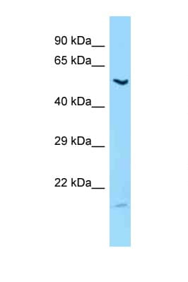 LIPC / Hepatic Lipase Antibody (aa303-352)