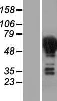 DPYSL4 / CRMP3 Protein (Over-Expression Lysate Myc-DDK (Flag))