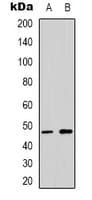 Polyclonal Rabbit anti-Human TP53 / p53 Antibody (C-Terminus, IHC, WB)