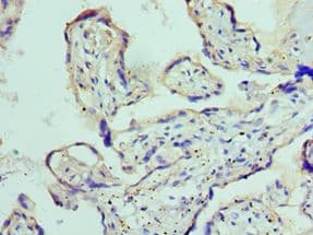 Polyclonal Rabbit anti-Human ADAM9 Antibody (aa475-685, IHC, WB)