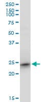 IHC-plus™ TC21 / RRAS2 Antibody (clone 2D3-4B8)