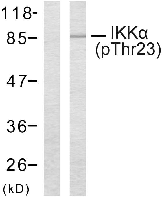 CHUK / IKKA / IKK Alpha Antibody (phospho-Thr23)