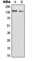 IHC-plus™ RAPH1 Antibody (Internal)