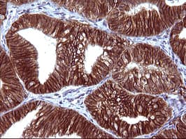EPCAM Antibody (clone OTI1H9)