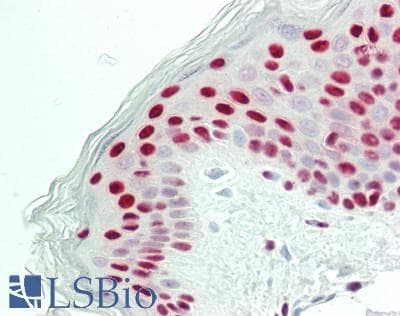 IHC-plus™ Polyclonal Rabbit anti-Human CCAR2 / KIAA1967 Antibody (aa1-50, IHC, WB)