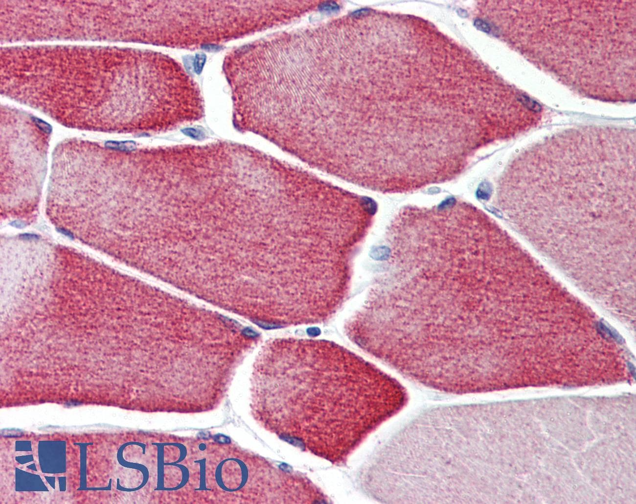 IHC-plus™ Monoclonal Mouse anti-Human CASQ2 / Calsequestrin 2 Antibody (clone 1C6, IHC, WB)