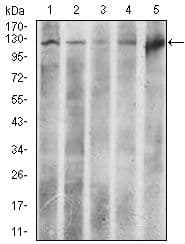 ACLY / ATP Citrate Lyase Antibody (Amino Acid: 306-502, clone 5F8D11)
