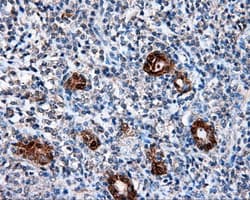 Monoclonal Mouse anti-Human L1CAM Antibody (clone OTI2H5, IHC, IF, WB)
