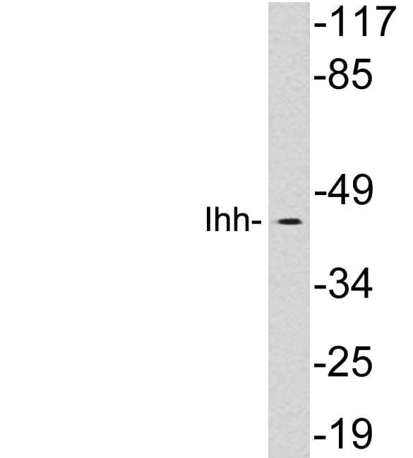 Polyclonal Rabbit anti-Human IHH Antibody (aa209-258, WB)