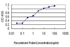 IHC-plus™ Monoclonal Mouse anti-Human SH3BP5 / SAB Antibody (clone 2B3, IHC, IF, WB)
