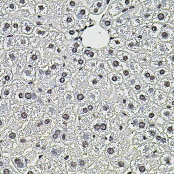SMN2 Antibody