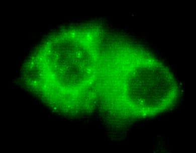 KRT7 / CK7 / Cytokeratin 7 Antibody