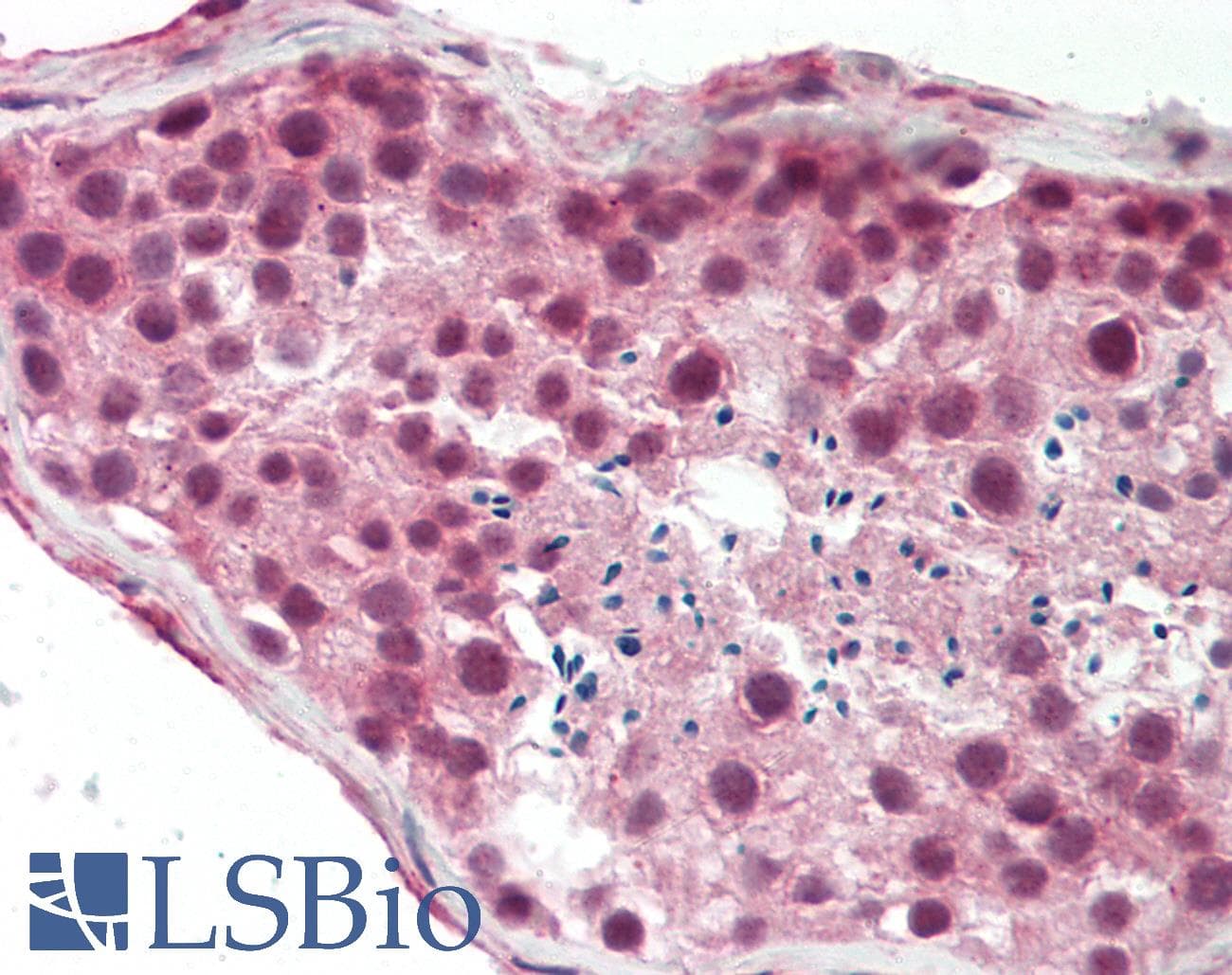 BRPF3 Antibody (aa801-850)