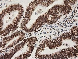 LOX / Lysyl Oxidase Antibody (clone OTI9G2)