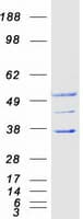 Human SFXN2 Protein (Recombinant Myc-DDK (Flag))
