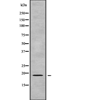 GPSM3 Antibody