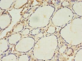 ACAA1 Antibody (aa27-331)