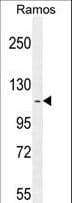 Polyclonal Rabbit anti-Human HIP1R Antibody (aa98-126, IHC, WB)
