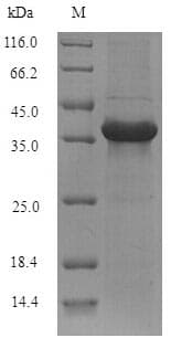 Mouse ABHD11 Protein (Recombinant 6His, N-terminus)