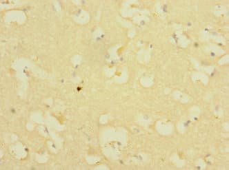 Polyclonal Rabbit anti-Human ICAM5 / ICAM-5 Antibody (IHC, WB)