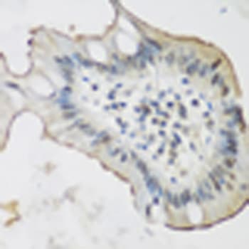 ALOX15 / 15-Lipoxygenase Antibody