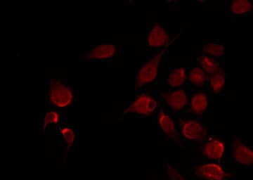 Polyclonal Rabbit anti-Human NFKBIA / IKB Alpha / IKBA Antibody (phospho-Ser32,phospho-Ser36, IHC, IF, WB)